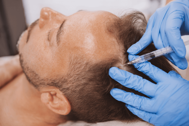 Cosmetologist holding syringe and man's head in hands Getting Hair Restoration treatment | Resa Medical Aesthetics in Scottsdale, AZ